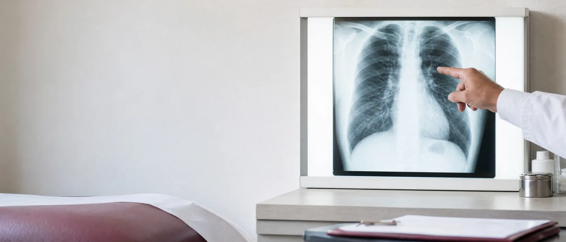 Chest x-ray on a lightbox showing the lung lining where mesothelioma grows